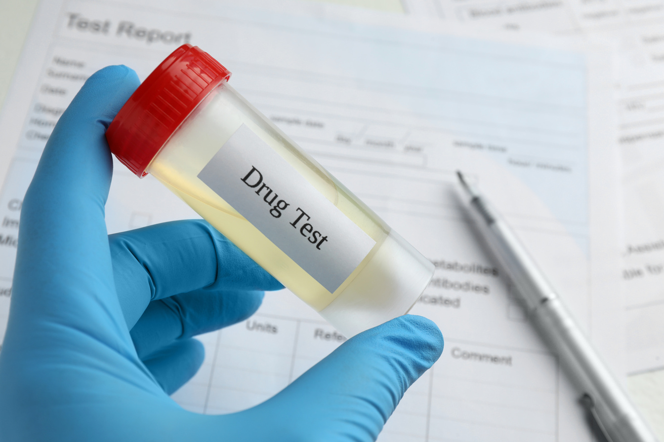 Drug Test. Laboratory Worker Holding Container with Urine Sample